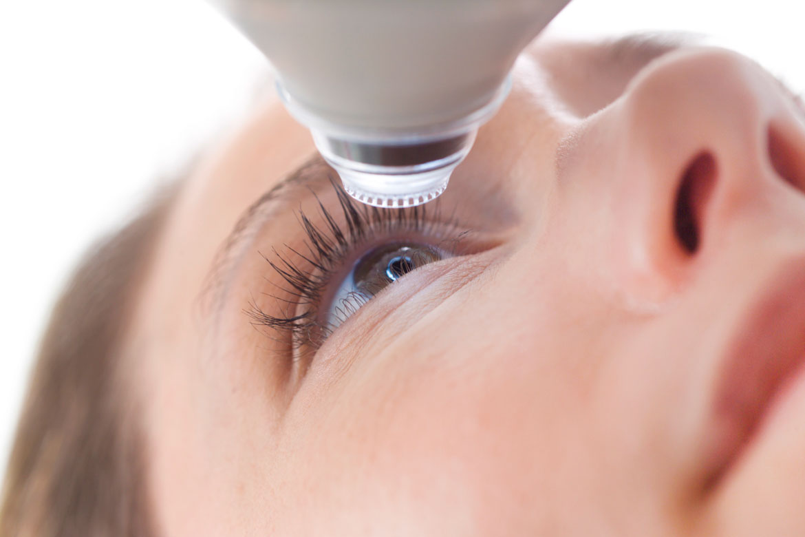 glaucoma
